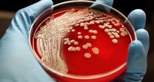اكتشاف بكتيريا قاتلة “مصاصة للدماء” وعطشانة لدم البشر