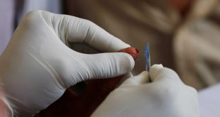 الصحة النيابية: 470 حالة وفاة بمرض الإيدز عن طريق مراكز التجميل أو الوشم
