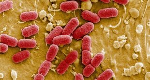 بكتيريا إيكولي الفتاكة تتفشى في بريطانيا وتقتل مصاباً