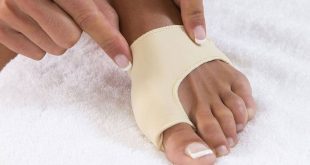 علاج بروز عظمة القدم بطرق بسيطة وبالجراحة التجميلية