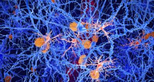 علاج مبتكر للصرع يعيد الذاكرة ويقي من النوبات